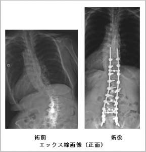 エックス線画像（正面）